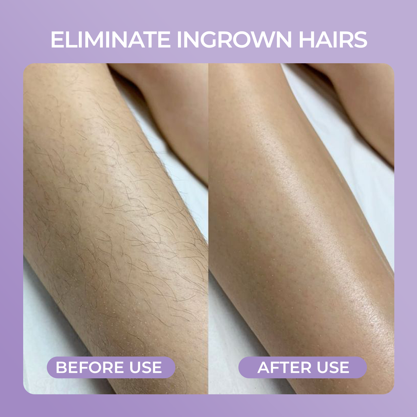 Barelume Crystal™ Hair Removal Pain Free Smooth Skin