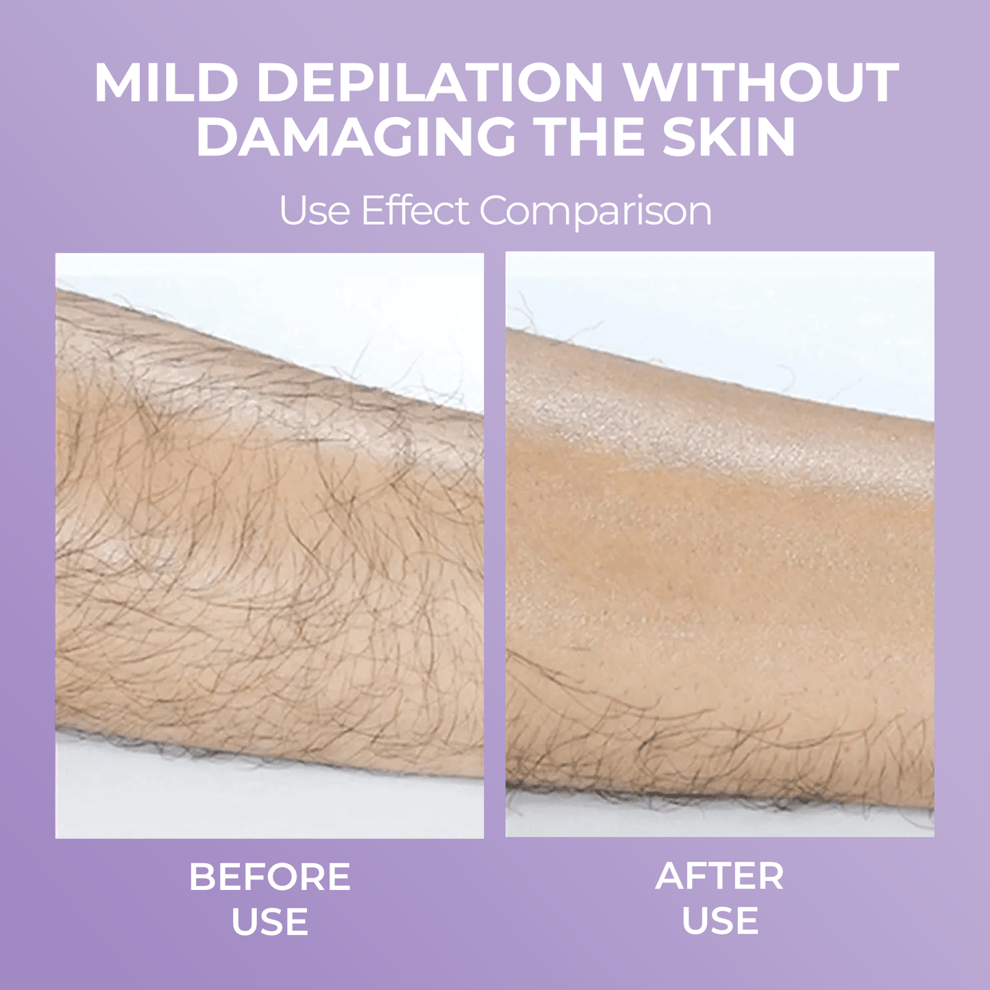 Barelume Crystal™ Hair Removal Pain Free Smooth Skin